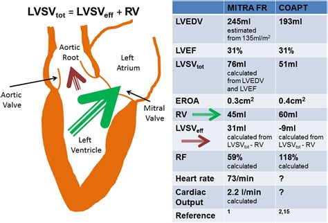 mitral regurgitation volume